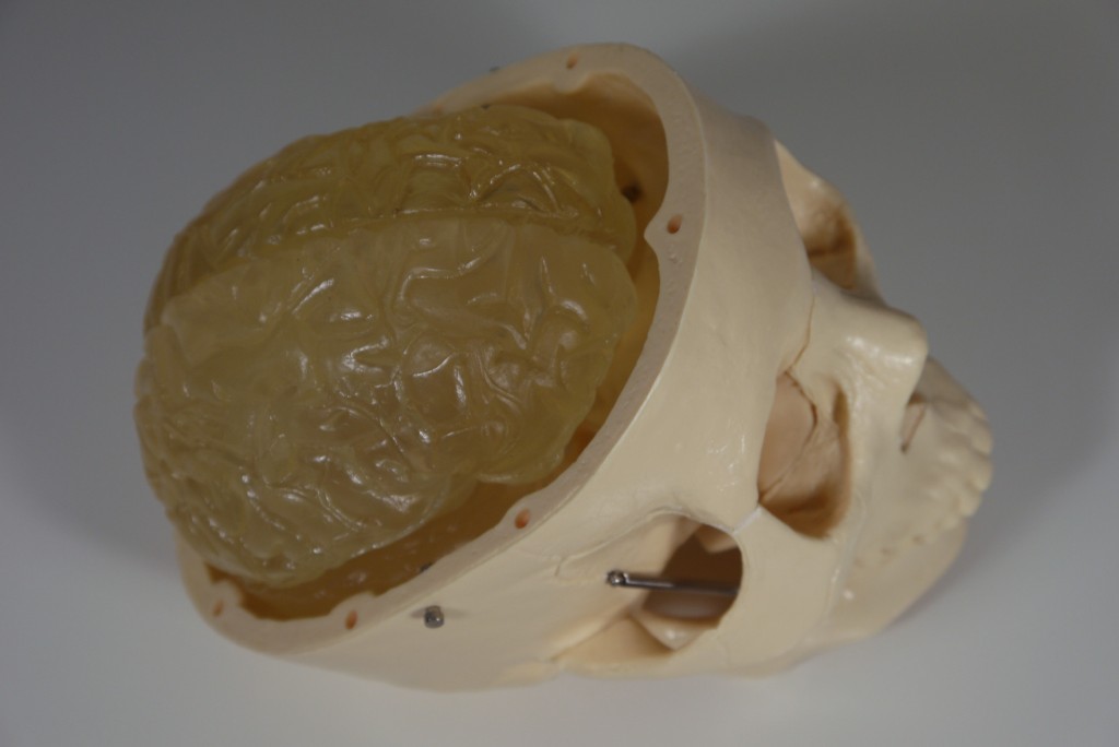 Human skull model with skull cap removed and brain exposed